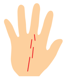 手相、運命線が切れ切れ